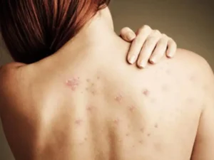 Phân biệt BHA và AHA trong sữa tắm