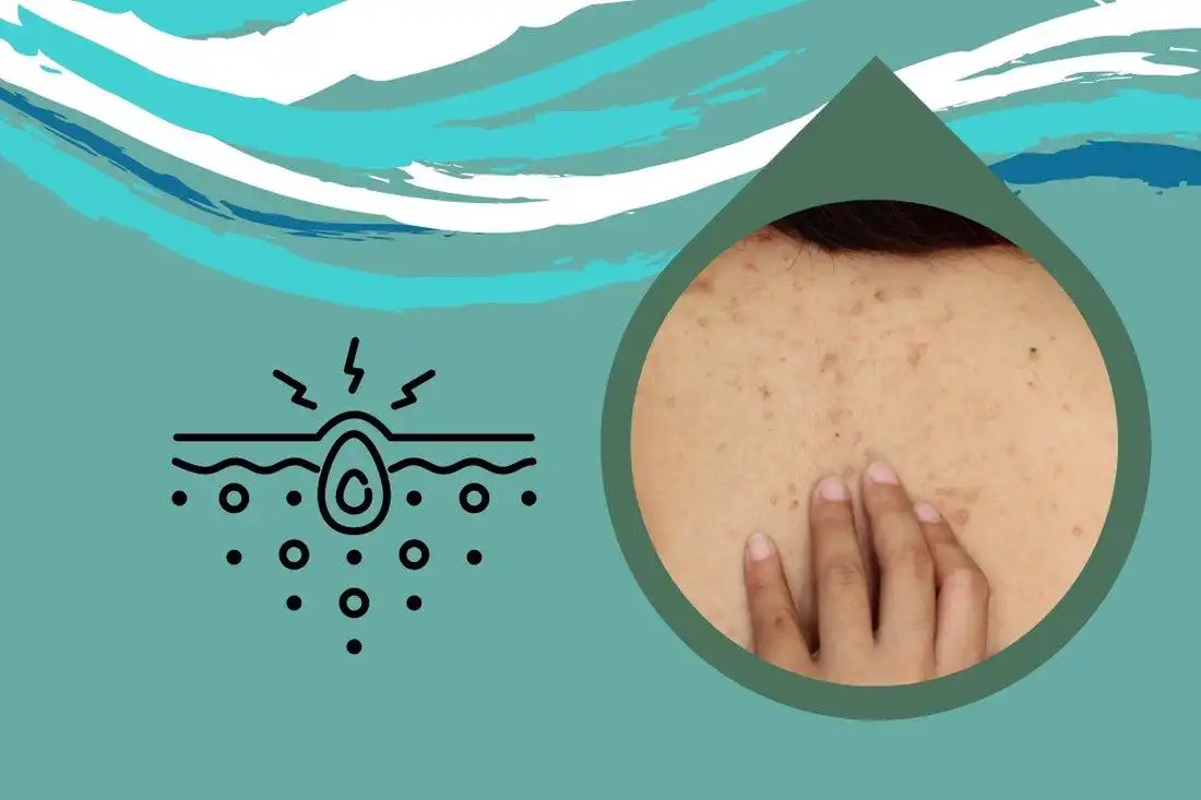 mun lung co nen dung dau xa nguyen nhan va cach tri